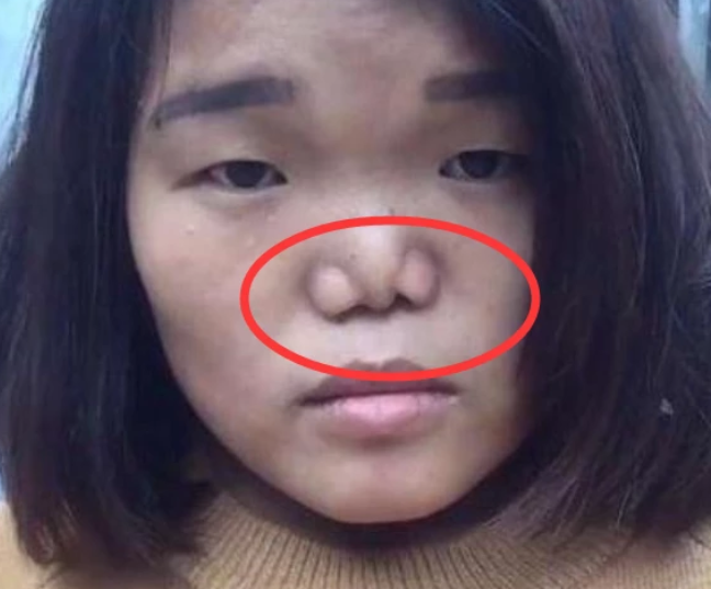 就算是你的颜值再高也忽略不了那两个朝天的鼻孔