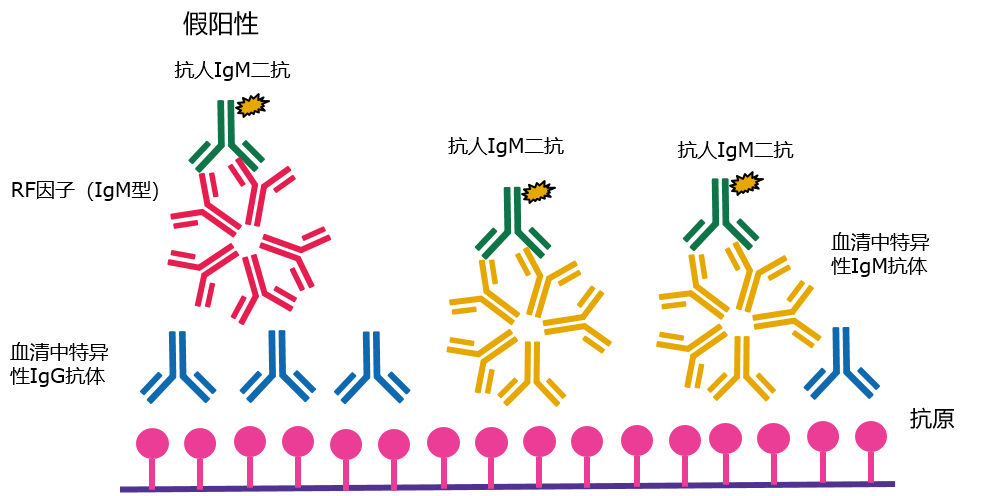 免疫,抗体,类风湿因子,肿瘤