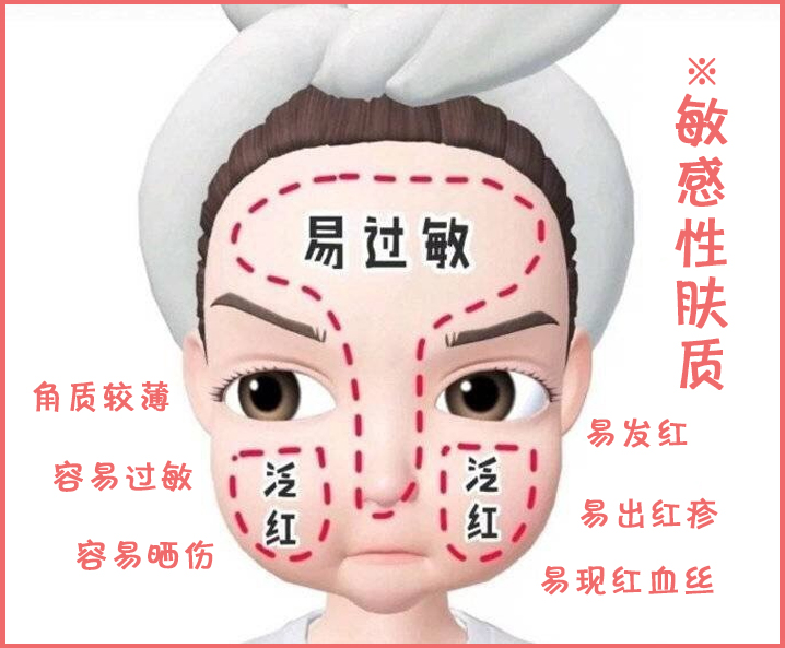 护理要点:混合性肤质需要把油性部分与干性部分区分护理,以控制t区