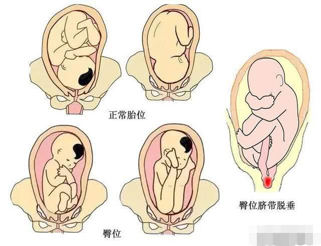 怀孕32周胎儿是怎么样的?孕妈们了解下!