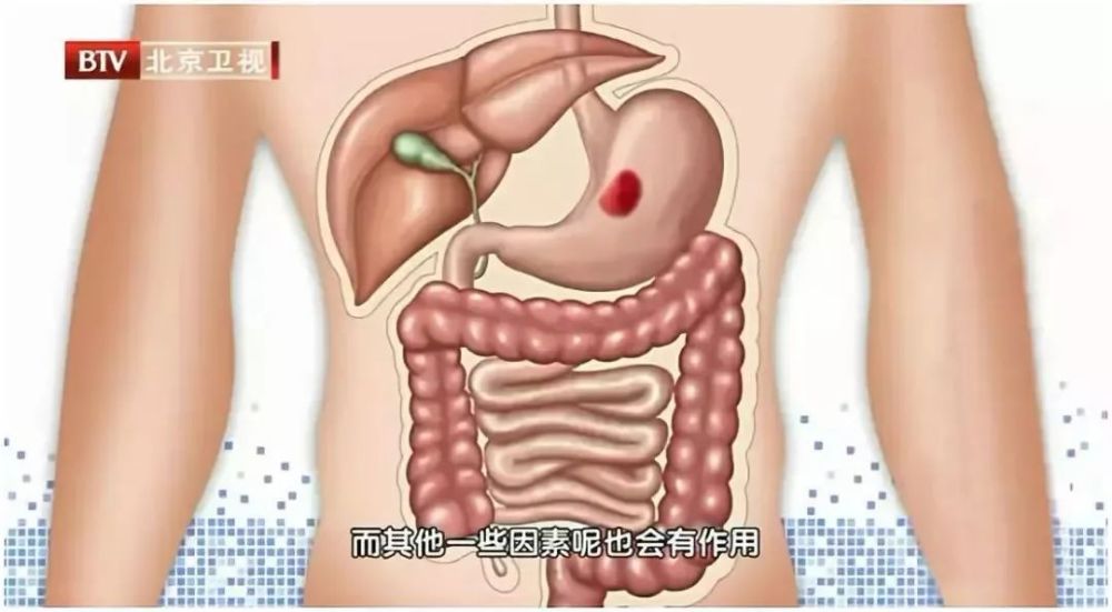 大肠,肠道,胃肠,消化系统,直肠,小肠