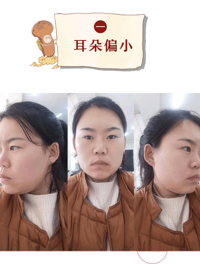 人际:耳朵无垂珠,说明六亲缘分浅,自身又比较敏感,人际交往方面会