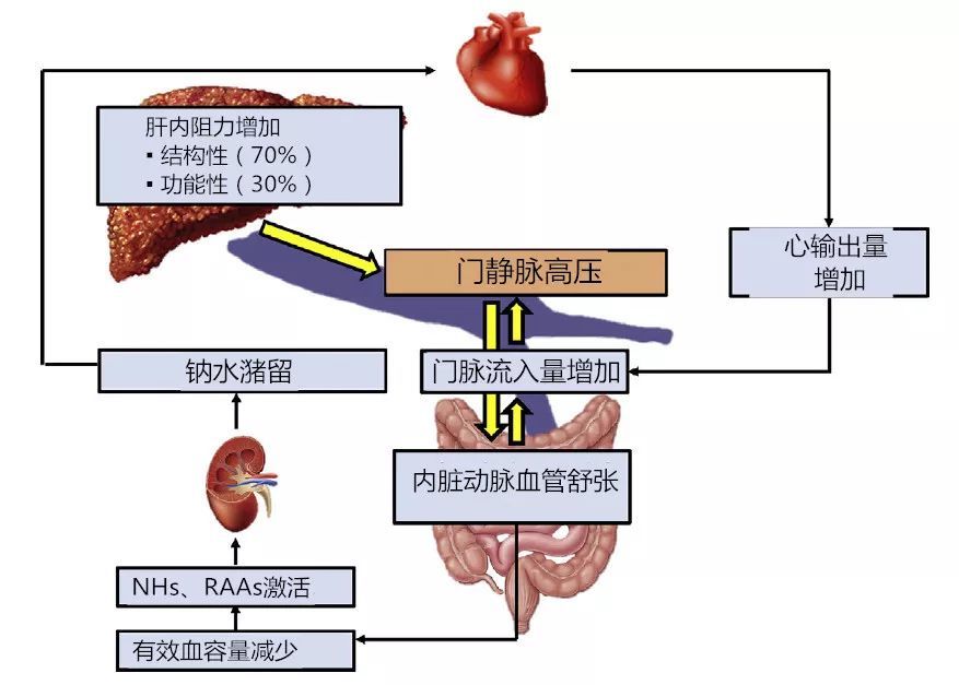 肝硬化,静脉,血管,医脉通,炎症,laura,肝损伤,血栓形成,门静脉高压,肝