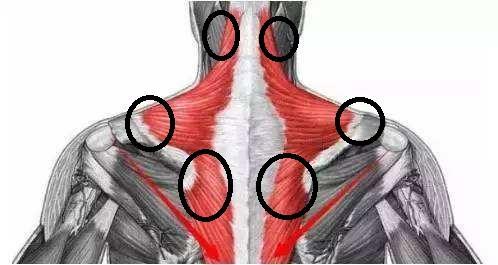 肩颈酸痛!这几块肌肉可能出现了问题!试试这几种缓解方式!