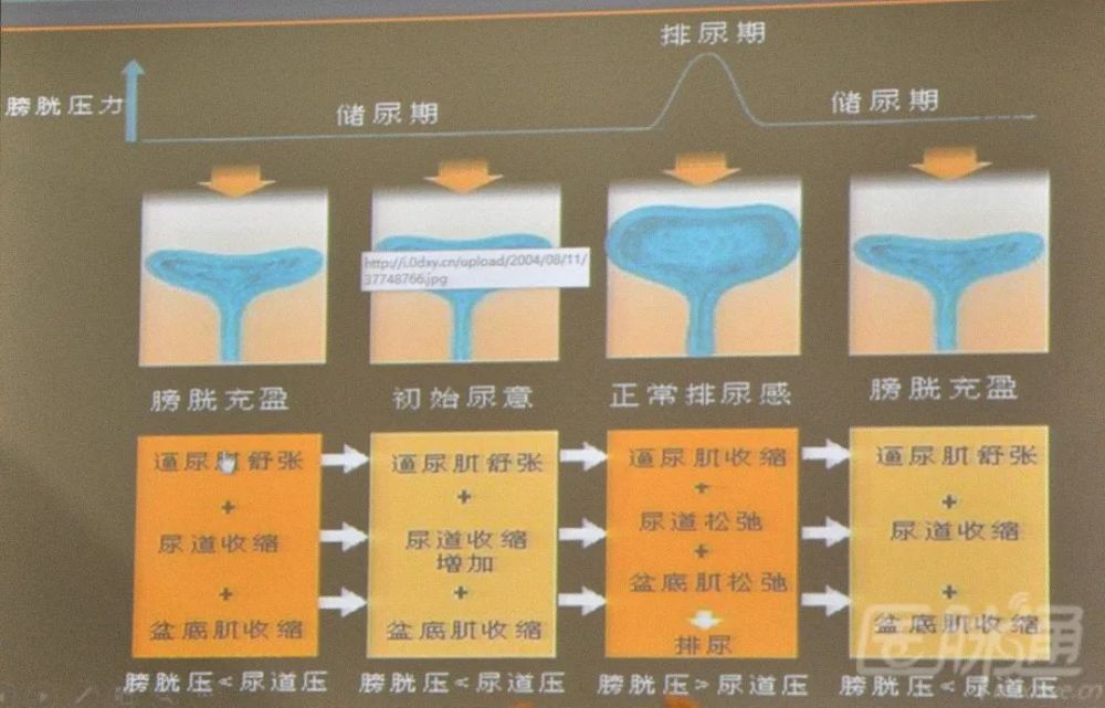 排尿反射示意图