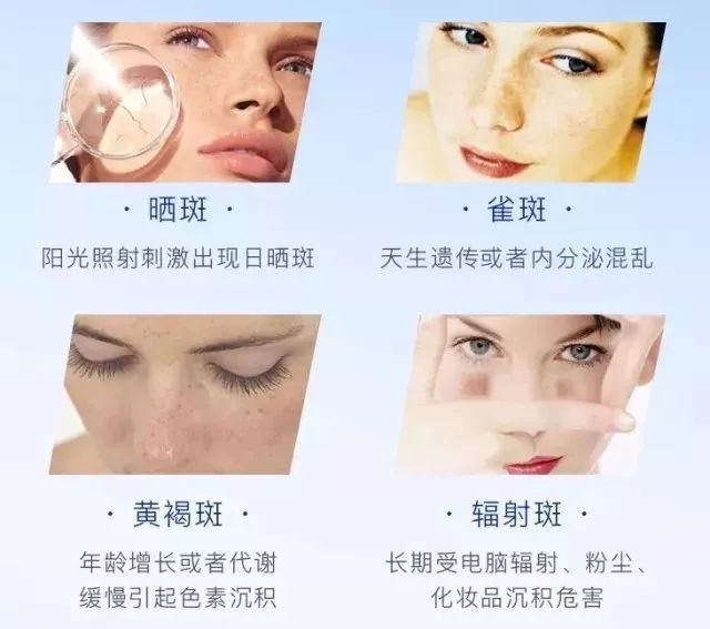 年龄增加,黑色素的分解能力会变弱,加速沉积,结块,滋生大量的色斑.