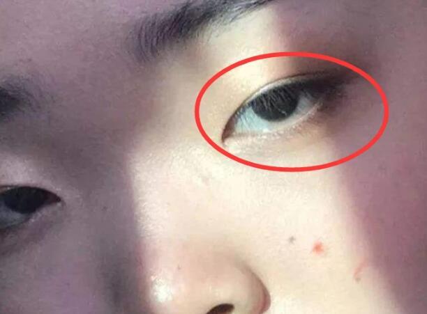 拥有死鱼眼的女生眼睛也会非常的不灵动,看起来没有朝气,会给人一种