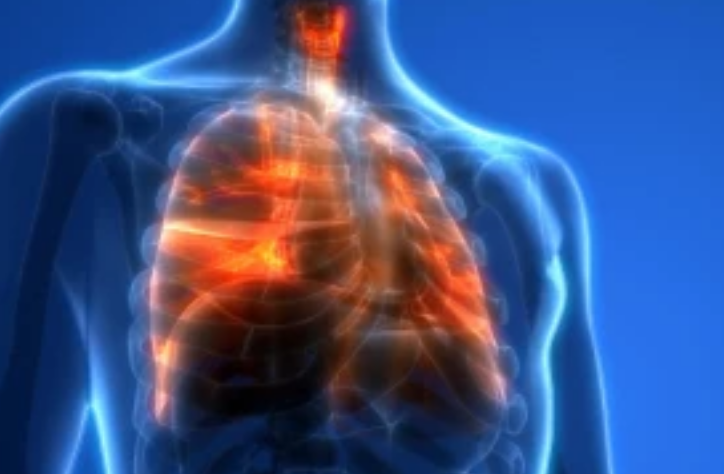 "肺癌"初期不疼不痒,一旦出现3个"不舒服",或是肺的呼救信号