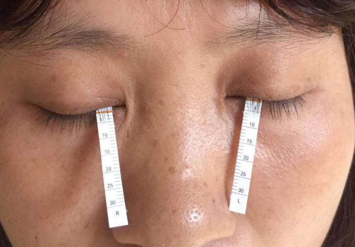 肝不好,眼知道,若眼睛没这