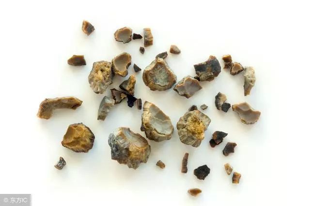 肾结石治疗碎石后应该如何护理
