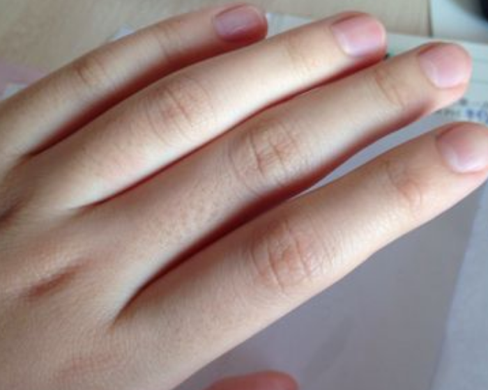 手指甲,女生,皮肤,手指,维生素