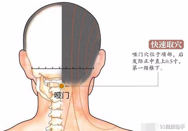 穴位养生头重,头痛,口干舌燥,嗓子发痒按哑门穴,散热