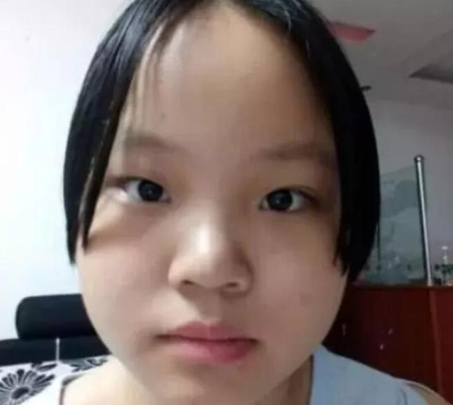 青春期最"糟蹋"颜值的3行为,全中的会变丑,学生党:咋不早说!