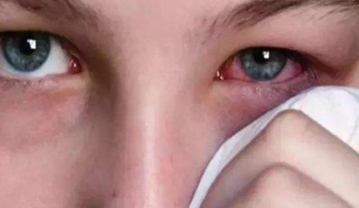 长期戴隐形眼镜对眼睛会有危害吗?跟着小编一起来看看吧