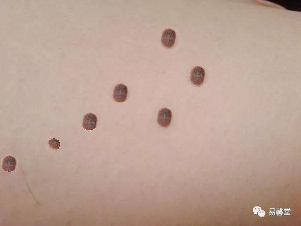 历史笑谈:好事者围绕帝王们长的痣,编下的那些瞎话