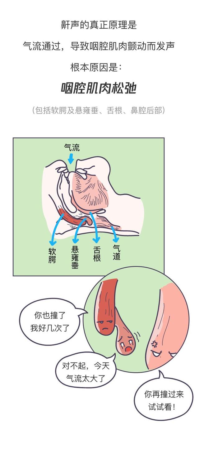 图解"打鼾"与"治疗"一目了然