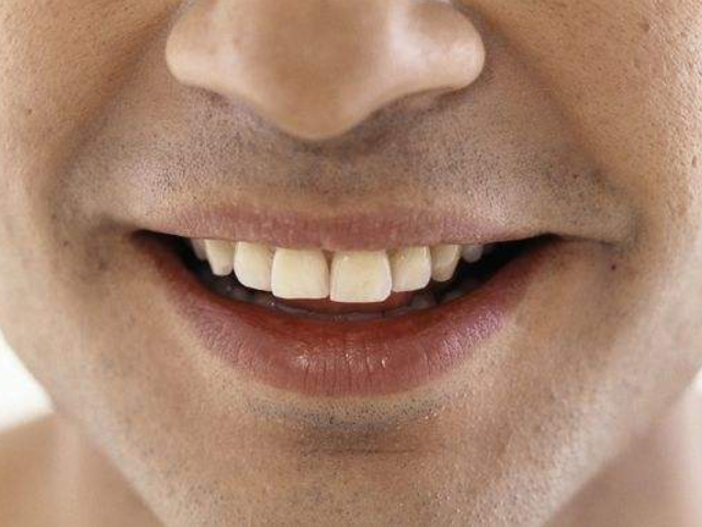 男人嘴巴"3个信号",提醒肾脏已出现了问题,没中就偷乐