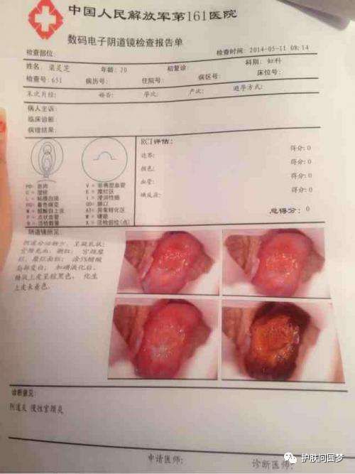 妇科体检你必须知道的那些事