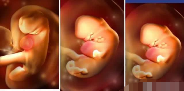 妊娠12周之前的新生命,称为"胚胎"还是"胎儿"?如何划分?