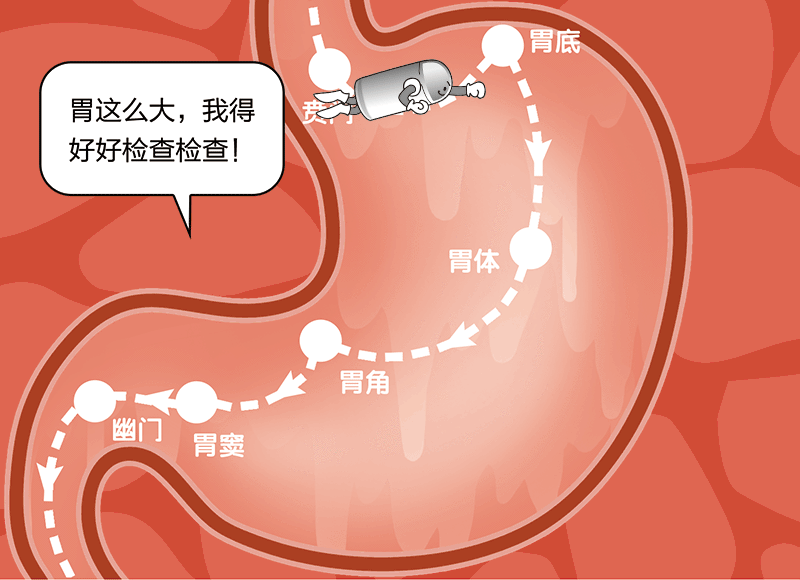 这是及时发现癌前病变的主要手段,及时发现胃癌,早期治疗预后好.