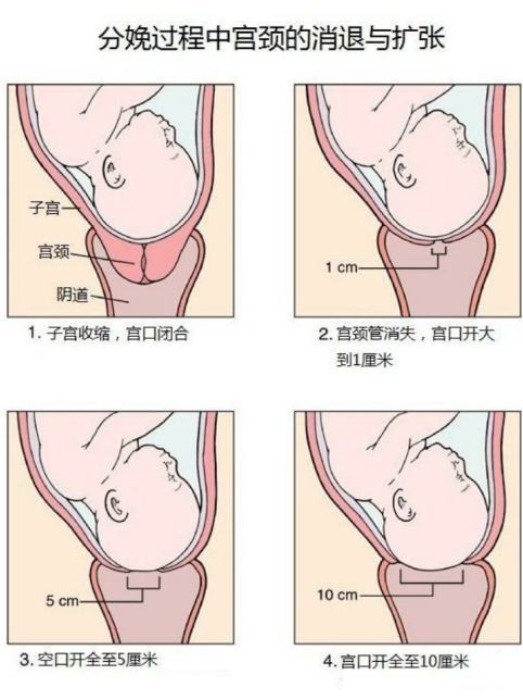 孕妇,子宫颈,产妇,宫缩,医生,顺产