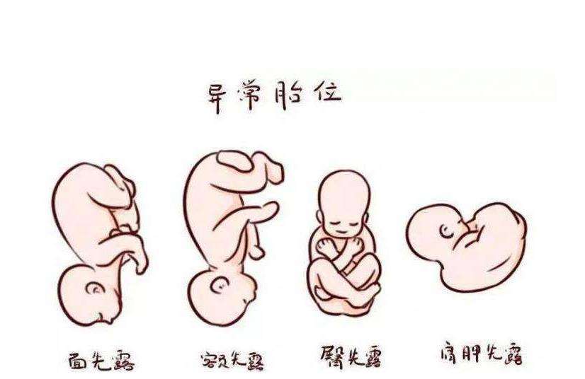 胎儿宫内窘迫_胎儿窘迫胎儿还能坚持多久_胎儿窘迫指征