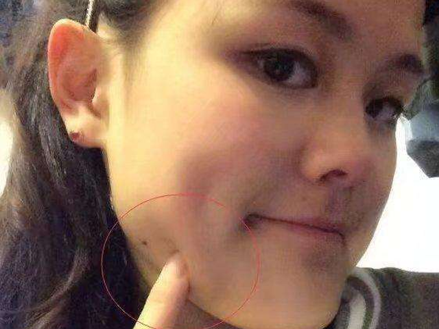 女人脸上这三个部位