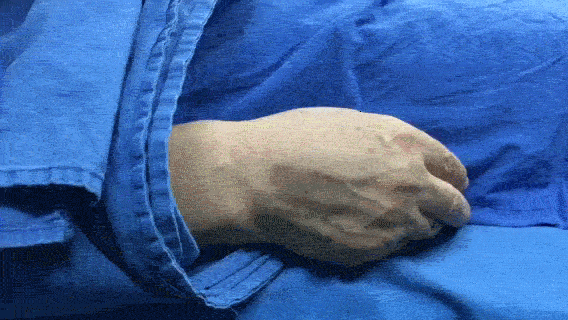 帕金森病患者易被