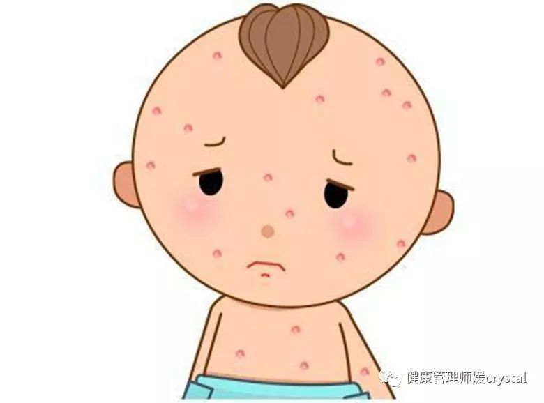 孩子接种过水痘疫苗不会感染了?冬天高发疾病,如何预防应对?
