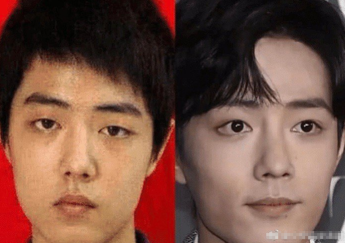 "魏无羡"被曝整容,拿肖战以往照片做对比,黑粉真的无孔不入