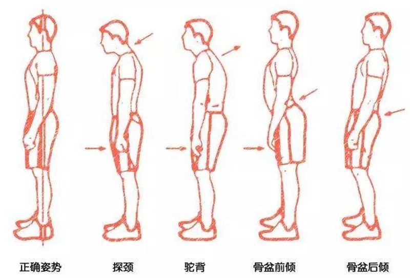 体态即身体的姿态,青少年不良体态是指身体姿态出现了问题,常见的