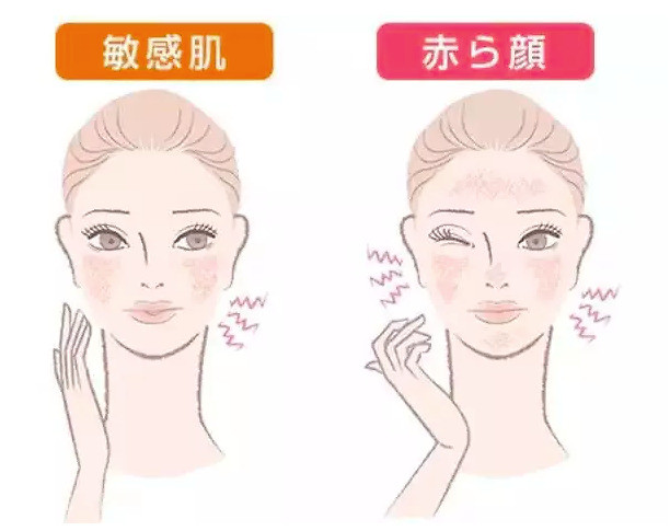 清潭:冬季肌肤干燥脱皮,该如何拯救你的敏感肌?