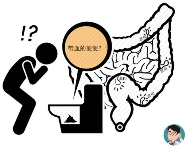 柏油样大便