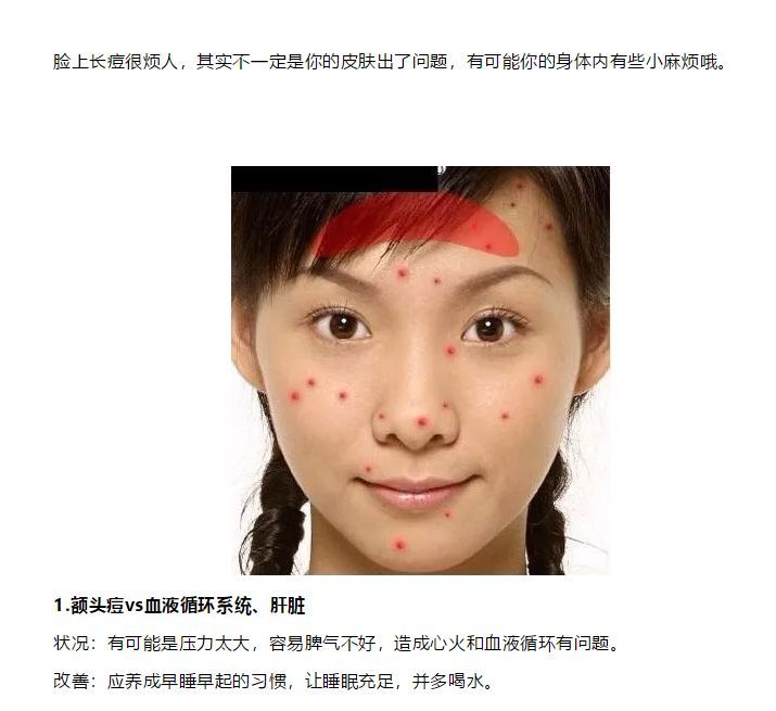 不同部位的痘痘真的对应不同器官的问题? 完全不正确!