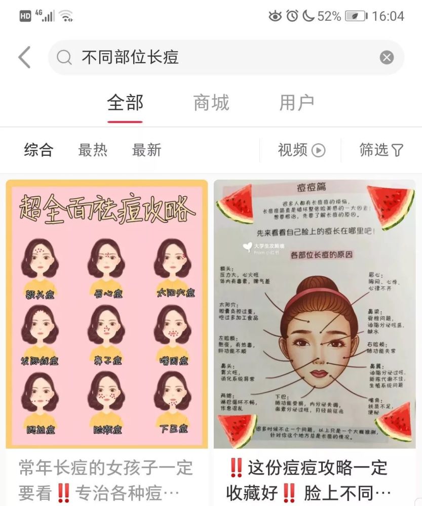 不同部位的痘痘真的对应不同器官的问题? 完全不正确!