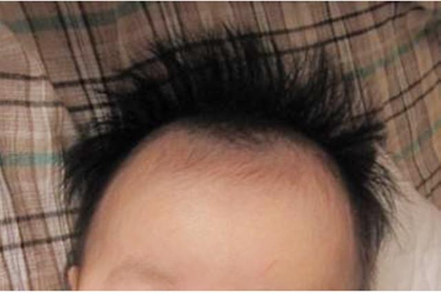 要么是往两边长,可是自己家的宝宝头发为啥是竖着长呢?
