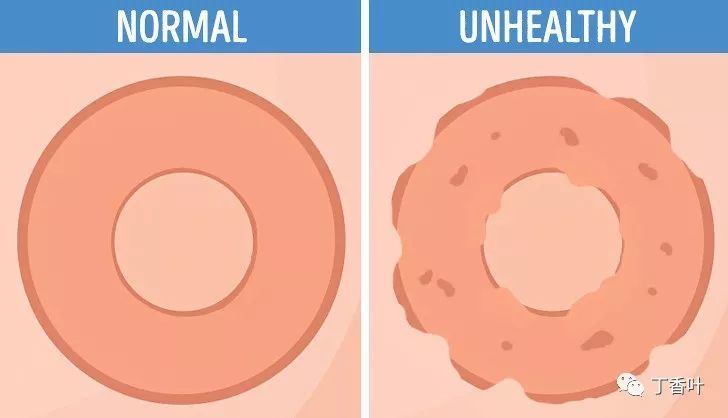 你的乳头可以说明你的健康状况