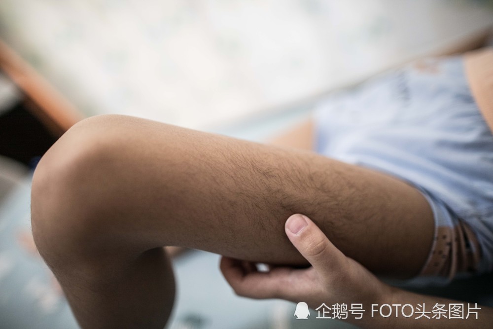 5岁男孩体毛比成年人还重被嘲笑"毛猴" 背后原因催泪