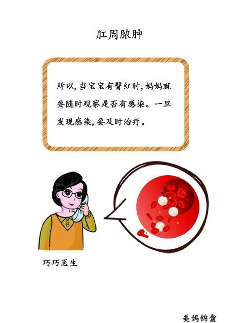 肛周脓肿,症状,肛门,患儿,宝宝