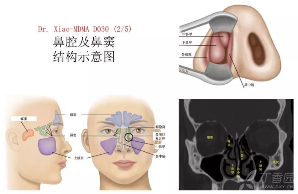 鼻炎vs 鼻窦炎?傻傻分不清?李医生教你区分