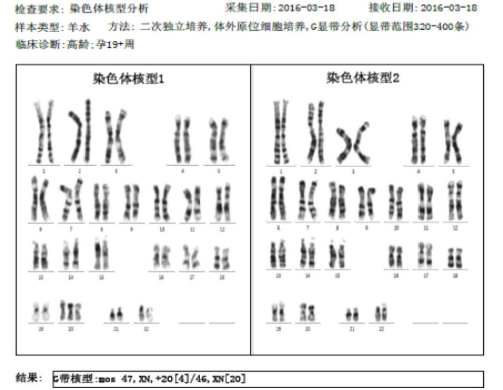 本期圆桌讨论通过对染色体嵌合的三个典型案例出发,分别对常染色体