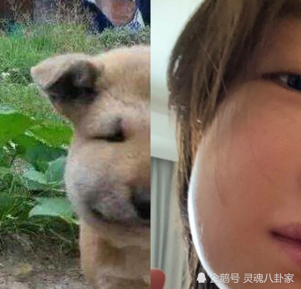 拔牙后晒自拍,右脸肿成球笑喷网友!