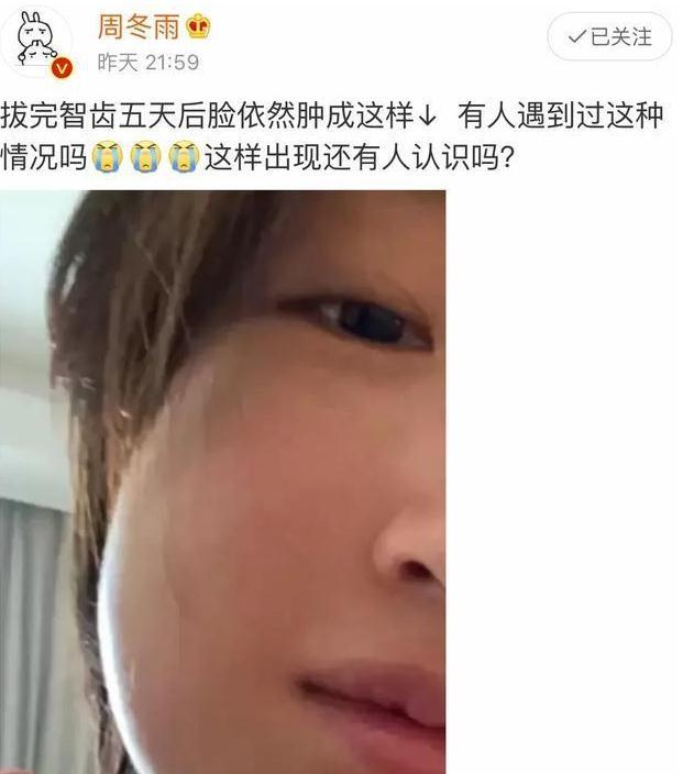 周冬雨拔智齿脸都肿了,被网友p图恶搞问捅了马蜂窝吗