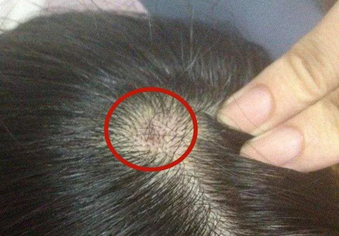 暴露出3大"问题",别不当回事