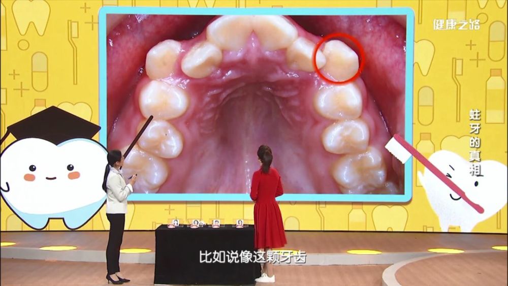 测试一:牙齿排列情况