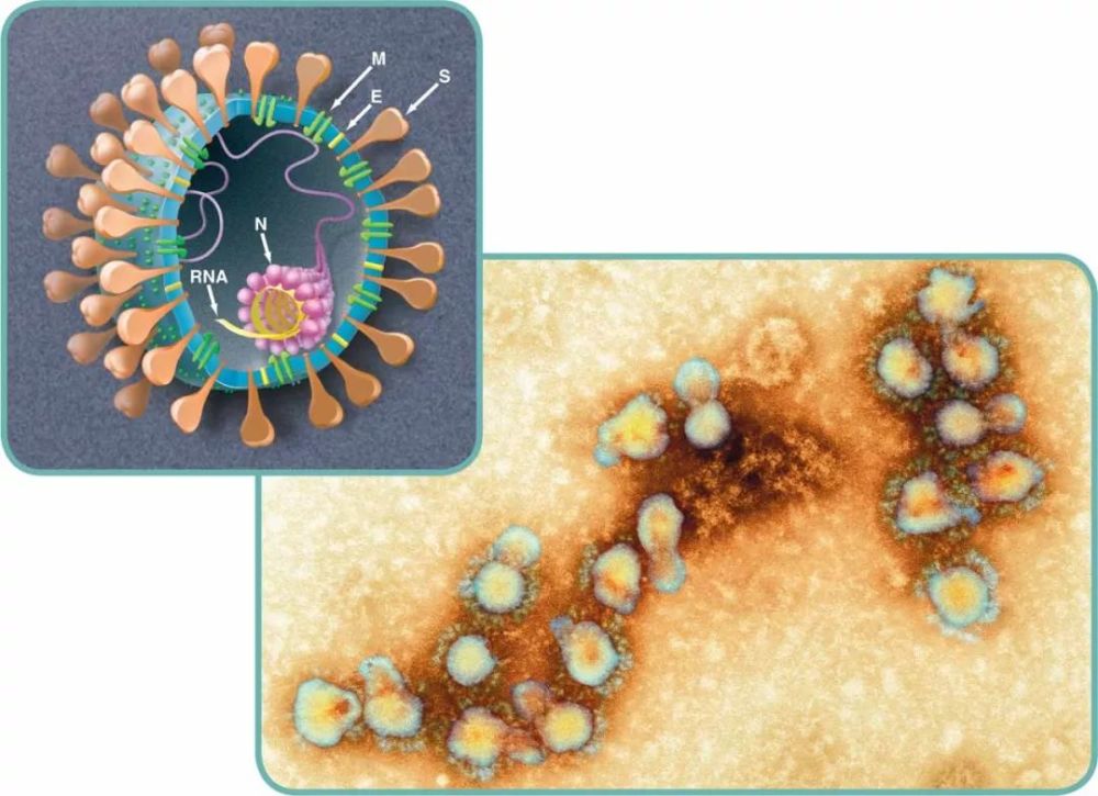 这就是"瘟神"冠状病毒的样子!电子显微镜下终现原形!大小125纳米!