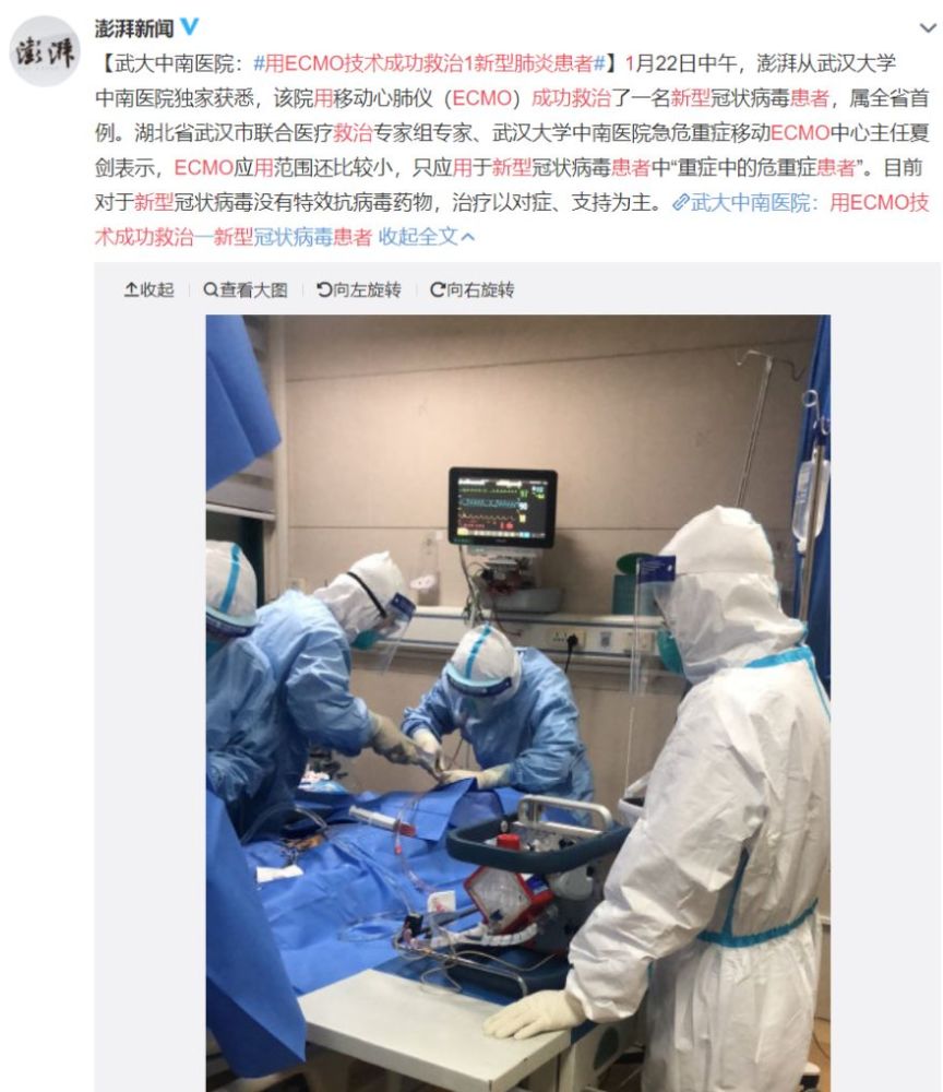 使用ecmo成功救治一名新型冠状病毒患者,背后意味着什么?