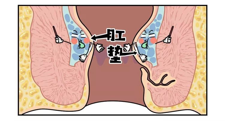 痔疮,肛门,肛垫,膀胱