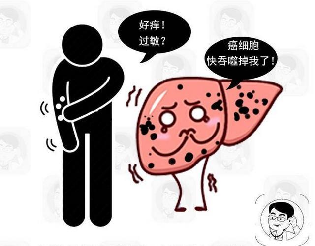 皮肤瘙痒或暗藏肿瘤?提醒:皮肤瘙痒与5个原因有关,别不当回事