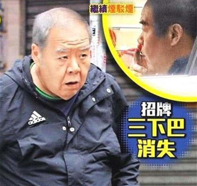 郑则仕,林燕明,明星,老戏骨,肥猫